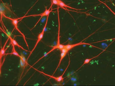 neurons